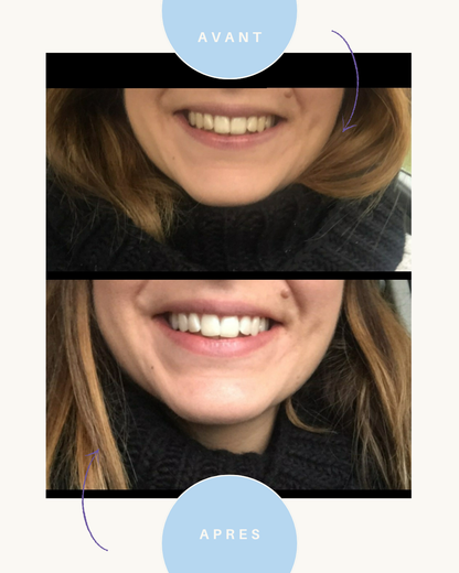 BELLISMILE - Sérum correcteur booster de blancheur