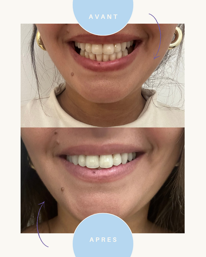 BELLISMILE - Sérum correcteur booster de blancheur