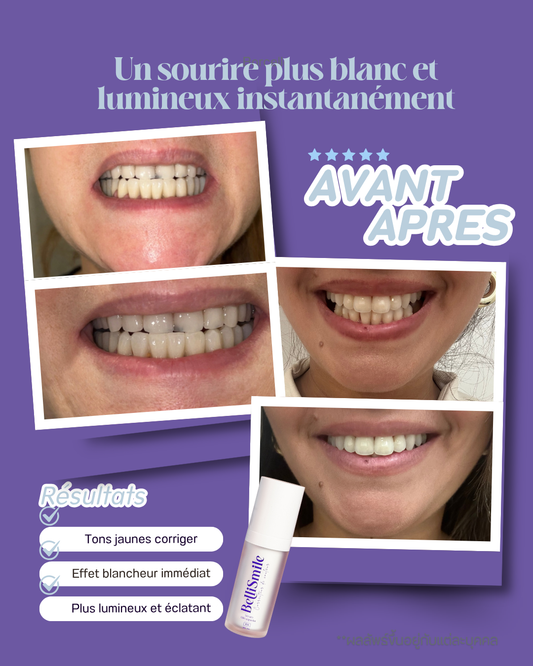 Sérum Correcteur de Couleur Dentaire – sourire blanc Instantané